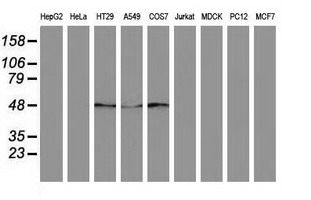 SQSTM1 Antibody - Western blot of extracts (35ug) from 9 different cell lines by using anti-SQSTM1 monoclonal antibody.