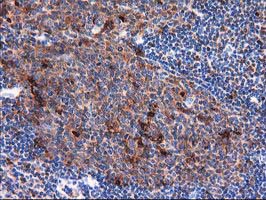 SQSTM1 Antibody - IHC of paraffin-embedded Human lymph node tissue using anti-SQSTM1 mouse monoclonal antibody. (Heat-induced epitope retrieval by 10mM citric buffer, pH6.0, 100C for 10min).