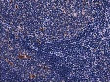 SQSTM1 Antibody - IHC of paraffin-embedded Human prostate tissue using anti-SQSTM1 mouse monoclonal antibody.