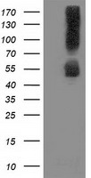 SQSTM1 Antibody - HEK293T cells were transfected with the pCMV6-ENTRY control (Left lane) or pCMV6-ENTRY SQSTM1 (Right lane) cDNA for 48 hrs and lysed. Equivalent amounts of cell lysates (5 ug per lane) were separated by SDS-PAGE and immunoblotted with anti-SQSTM1.