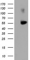 SQSTM1 Antibody - HEK293T cells were transfected with the pCMV6-ENTRY control (Left lane) or pCMV6-ENTRY SQSTM1 (Right lane) cDNA for 48 hrs and lysed. Equivalent amounts of cell lysates (5 ug per lane) were separated by SDS-PAGE and immunoblotted with anti-SQSTM1.