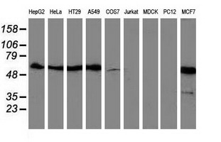 SQSTM1 Antibody - Western blot of extracts (35 ug) from 9 different cell lines by using anti-SQSTM1 monoclonal antibody (HepG2: human; HeLa: human; SVT2: mouse; A549: human; COS7: monkey; Jurkat: human; MDCK: canine; PC12: rat; MCF7: human).