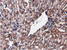SQSTM1 Antibody - IHC of paraffin-embedded Human liver tissue using anti-SQSTM1 mouse monoclonal antibody.