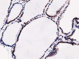 SQSTM1 Antibody - IHC of paraffin-embedded Human thyroid tissue using anti-SQSTM1 mouse monoclonal antibody.