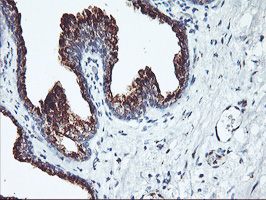 SQSTM1 Antibody - IHC of paraffin-embedded Human prostate tissue using anti-SQSTM1 mouse monoclonal antibody. (Heat-induced epitope retrieval by 10mM citric buffer, pH6.0, 100C for 10min).