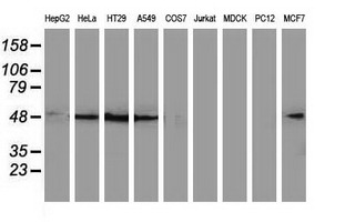 SQSTM1 Antibody - Western blot of extracts (35 ug) from 9 different cell lines by using anti-SQSTM1 monoclonal antibody.