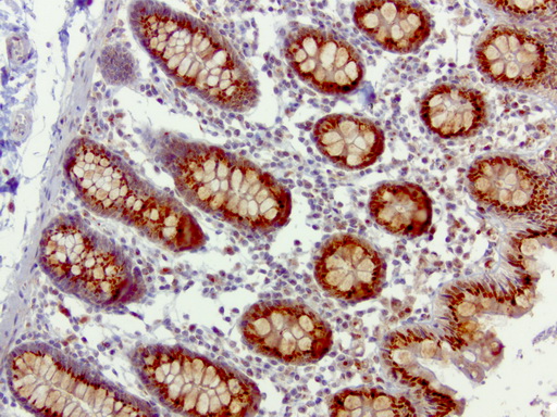 SQSTM1 Antibody - Immunohistochemical staining of paraffin-embedded human colon using anti-SQSTM1 clone UMAB12 mouse monoclonal antibody  at 1:100 with Polink2 Broad HRP DAB detection kit; heat-induced epitope retrieval with GBI Accel pH 8.7 HIER buffer using pressure chamber for 3 minutes at 110C. Strong cytoplasmic staining is seen in the colon epithelial cells.