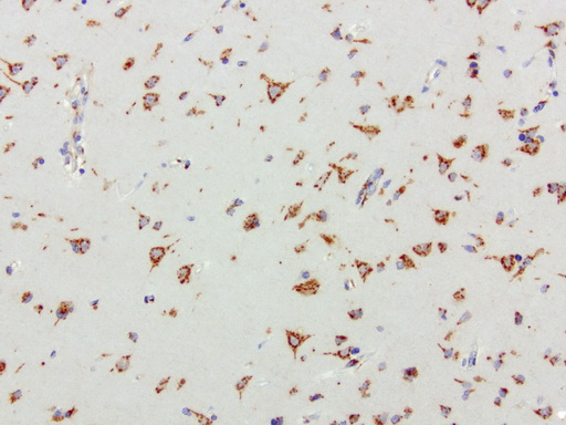 SQSTM1 Antibody - Immunohistochemical staining of paraffin-embedded human brain using anti-SQSTM1 clone UMAB12 mouse monoclonal antibody  at 1:100 with Polink2 Broad HRP DAB detection kit; heat-induced epitope retrieval with GBI Accel pH 8.7 HIER buffer using pressure chamber for 3 minutes at 110C. Strong cytoplasmic staining is seen in the nueral cells.