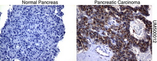SQSTM1 Antibody - Immunohistochemical staining of paraffin-embedded pancreas tissue using anti-SQSTM1mouse monoclonal antibody. (Clone UMAB12, dilution 1:100; heat-induced epitope retrieval by 10mM citric buffer, pH6.0, 120C for 3min)