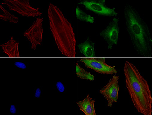 SQSTM1 Antibody - Immunofluorescent staining of HeLa cells using SQSTM1 mouse monoclonal antibody  green). Actin filaments were labeled with TRITC-phalloidin. (red), and nuclear with DAPI. (blue). The three-color overlay image is located at the bottom-right corner.
