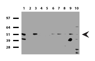 SQSTM1 Antibody - Western blot of human tissue lysates. (15ug) from 10 different tissues. (1: Testis, 2: Omentum, 3: Uterus, 4: Breast, 5: Brain, 6: Liver, 7: Ovary, 8: Thyroid 9: Colon, 10: Spleen). Diluation: 1:500.