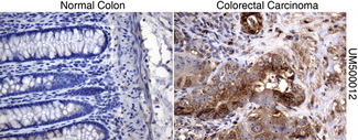 SQSTM1 Antibody - Immunohistochemical staining of paraffin-embedded colon tissue using anti-SQSTM1mouse monoclonal antibody. (Clone UMAB12, dilution 1:100; heat-induced epitope retrieval by 10mM citric buffer, pH6.0, 120C for 3min)