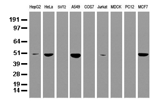 SQSTM1 Antibody - Western blot analysis of extracts. (35ug) from 9 different cell lines by using anti-SQSTM1 monoclonal antibody. (Clone UMAB12) at 1:500.