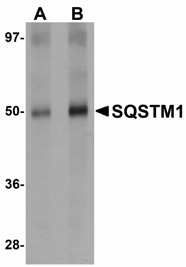 SQSTM1 Antibody - Western blot of SQSTM1 in Human spleen tissue lysate with SQSTM1 antibody at (A) 1 and (B) 2 ug/ml.