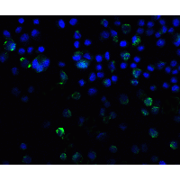 SQSTM1 Antibody - Immunofluorescence of SQSTM1 in A431 cells with SQSTM1 antibody at 20 µg/ml.