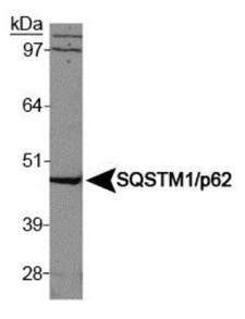 SQSTM1 Antibody - Western Blot: p62/SQSTM1 Antibody - Analysis of SQSTM1/p62 in HeLa whole cell lysates