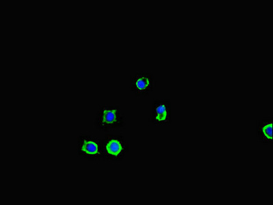 SQSTM1 Antibody - Immunofluorescent analysis of mcf-7 cells diluted at 1:100 and Alexa Fluor 488-congugated AffiniPure Goat Anti-Rabbit IgG(H+L)