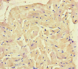 SQSTM1 Antibody - Immunohistochemistry of paraffin-embedded human heart tissue at dilution of 1:100