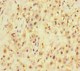 SQSTM1 Antibody - Immunohistochemistry of paraffin-embedded human placenta tissue at dilution of 1:100