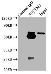 SQSTM1 Antibody - Immunoprecipitating SQSTM1 in Hela whole cell lysate Lane 1: Rabbit control IgG (1µg) instead of product in Hela whole cell lysate.For western blotting,a HRP-conjugated Protein G antibody was used as the Secondary antibody (1/2000) Lane 2: product (6µg) + Hela whole cell lysate (500µg) Lane 3: Hela whole cell lysate (10µg)