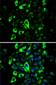 SQSTM1 Antibody - Immunofluorescence analysis of HeLa cells using SQSTM1 antibody. Blue: DAPI for nuclear staining.