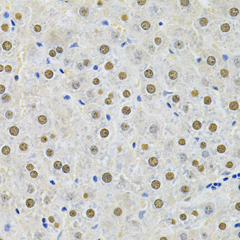 SQSTM1 Antibody - Immunohistochemistry of paraffin-embedded rat liver using SQSTM1 Antibody at dilution of 1:200 (40x lens).