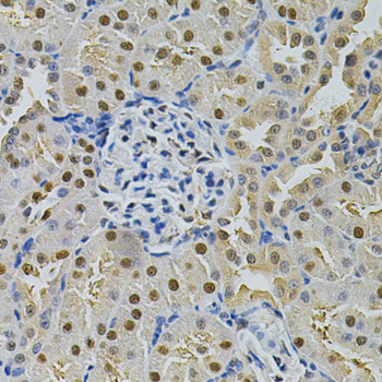 SQSTM1 Antibody - Immunohistochemistry of paraffin-embedded rat kidney using SQSTM1 Antibody at dilution of 1:200 (40x lens).