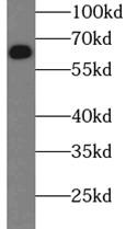 SQSTM1 Antibody - HEK-293 cells were subjected to SDS PAGE followed by western blot with SQSTM1 antibody at dilution of 1:2000w