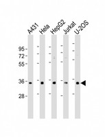 SR Protein / RNPS1 Antibody - All lanes: Anti-RNPS1 Antibody (N-Term) at 1:500-1:1000 dilution. Lane 1: A431 whole cell lysate. Lane 2: HeLa whole cell lysate. Lane 3: HepG2 whole cell lysate. Lane 4: Jurkat whole cell lysate. Lane 5: U-2OS whole cell lysate Lysates/proteins at 20 ug per lane. Secondary Goat Anti-Rabbit IgG, (H+L), Peroxidase conjugated at 1:10000 dilution. Predicted band size: 34 kDa. Blocking/Dilution buffer: 5% NFDM/TBST.