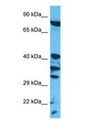 SR Protein / RNPS1 Antibody - Western blot of RNPS1 Antibody with human HepG2 Whole Cell lysate.  This image was taken for the unconjugated form of this product. Other forms have not been tested.