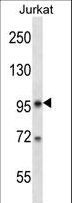 SR140 / U2SURP Antibody - SR140 Antibody western blot of Jurkat cell line lysates (35 ug/lane). The SR140 antibody detected the SR140 protein (arrow).