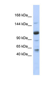 SR140 / U2SURP Antibody - U2SURP / SR140 antibody Western blot of Fetal Heart lysate. This image was taken for the unconjugated form of this product. Other forms have not been tested.