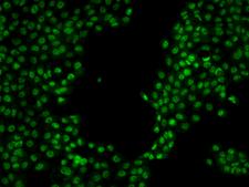 SR140 / U2SURP Antibody - Immunofluorescence staining of U2SURP in A431 cells. Cells were fixed with 4% PFA, permeabilzed with 0.1% Triton X-100 in PBS, blocked with 10% serum, and incubated with rabbit anti-Human U2SURP polyclonal antibody (dilution ratio 1:200) at 4°C overnight. Then cells were stained with the Alexa Fluor 488-conjugated Goat Anti-rabbit IgG secondary antibody (green). Positive staining was localized to Nucleus.
