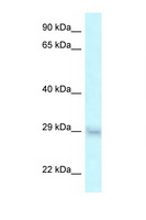 SRA1 / SRA Antibody - SRA1 antibody Western blot of HT1080 Cell lysate. Antibody concentration 1 ug/ml.  This image was taken for the unconjugated form of this product. Other forms have not been tested.