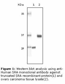 SRA1 / SRA Antibody