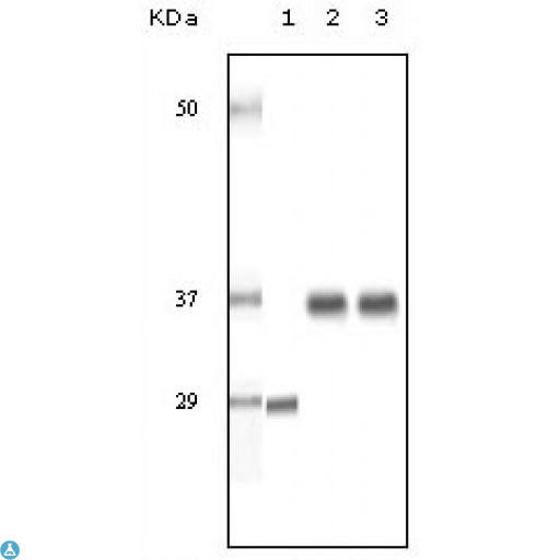 SRA1 / SRA Antibody - Western Blot (WB) analysis using SRA1 Monoclonal Antibody against truncated SRA recombinant protein (1), Human Ovary cancer tissue lysate (2) and A431 cell lysate (3).