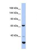 SRBD1 Antibody - Western blot of Human COLO205. SRBD1 antibody dilution 1.0 ug/ml.  This image was taken for the unconjugated form of this product. Other forms have not been tested.