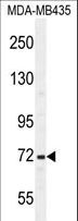 SRBD1 Antibody - SRBD1 Antibody western blot of MDA-MB435 cell line lysates (35 ug/lane). The SRBD1 antibody detected the SRBD1 protein (arrow).