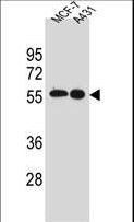 SRC Antibody - SRC Antibody western blot of MCF-7,A431 cell line lysates (35 ug/lane). The SRC antibody detected the SRC protein (arrow).