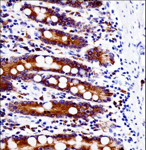 SRC Antibody - SRC Antibody immunohistochemistry of formalin-fixed and paraffin-embedded human small intestine tissue followed by peroxidase-conjugated secondary antibody and DAB staining.