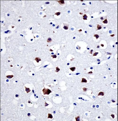 SRC Antibody - SRC Antibody immunohistochemistry of formalin-fixed and paraffin-embedded human brain tissue followed by peroxidase-conjugated secondary antibody and DAB staining.