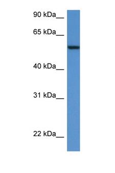 SRC Antibody - SRC antibody Western blot of 721_B Cell lysate. Antibody concentration 1 ug/ml. This image was taken for the unconjugated form of this product. Other forms have not been tested.
