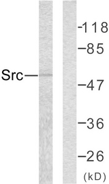 SRC Antibody - Western blot analysis of lysates from COLO205 cells, using Src Antibody. The lane on the right is blocked with the synthesized peptide.