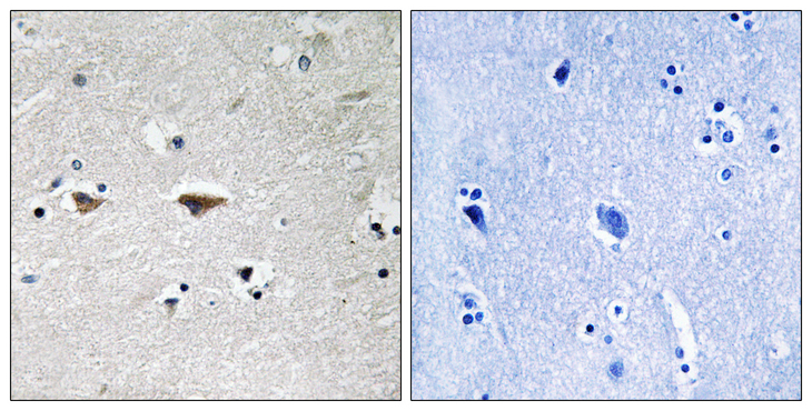 SRC Antibody - Immunohistochemistry analysis of paraffin-embedded human brain tissue, using Src Antibody. The picture on the right is blocked with the synthesized peptide.
