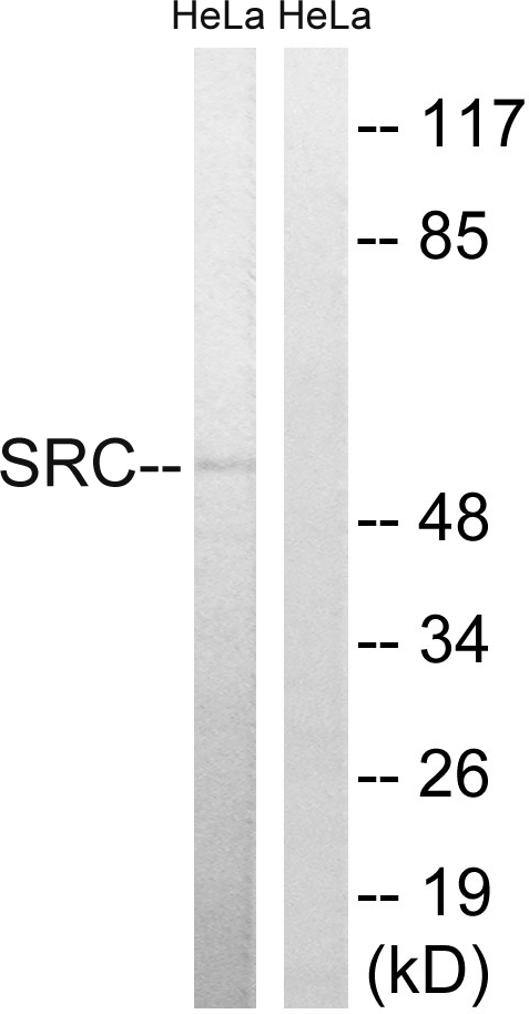 SRC Antibody - Western blot analysis of lysates from HeLa cells, treated with Hu 2nM 24h, using Src Antibody. The lane on the right is blocked with the synthesized peptide.