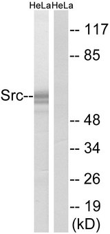 SRC Antibody - Western blot analysis of lysates from HeLa cells, using Src Antibody. The lane on the right is blocked with the synthesized peptide.