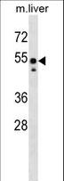 SRC Antibody - Mouse Src Antibody western blot of mouse liver tissue lysates (35 ug/lane). The Src antibody detected the Src protein (arrow).