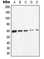 SRC Antibody - Western blot analysis of c-SRC expression in K562 (A); HeLa (B); MCF7 (C); HepG2 (D); mouse primary astrocytes (E) whole cell lysates.