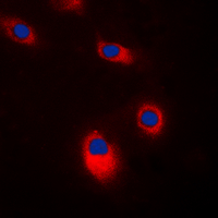 SRC Antibody - Immunofluorescent analysis of c-SRC staining in K562 cells. Formalin-fixed cells were permeabilized with 0.1% Triton X-100 in TBS for 5-10 minutes and blocked with 3% BSA-PBS for 30 minutes at room temperature. Cells were probed with the primary antibody in 3% BSA-PBS and incubated overnight at 4 C in a humidified chamber. Cells were washed with PBST and incubated with a DyLight 594-conjugated secondary antibody (red) in PBS at room temperature in the dark. DAPI was used to stain the cell nuclei (blue).