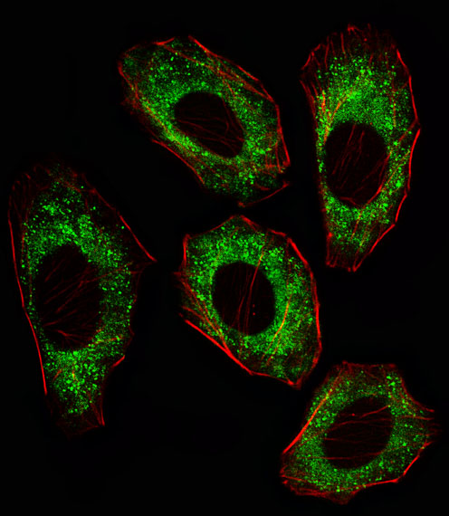 SRC Antibody - Fluorescent image of A549 cell stained with SRC Antibody. A549 cells were fixed with 4% PFA (20 min), permeabilized with Triton X-100 (0.1%, 10 min), then incubated with SRC primary antibody (1:25, 1 h at 37°C). For secondary antibody, Alexa Fluor 488 conjugated donkey anti-mouse antibody (green) was used (1:400, 50 min at 37°C). Cytoplasmic actin was counterstained with Alexa Fluor 555 (red) conjugated Phalloidin (7units/ml, 1 h at 37°C). SRC immunoreactivity is localized to Cytoplasm significantly.
